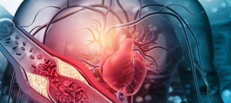 Cuál es la mejor fruta para limpiar arterias y venas de forma natural?