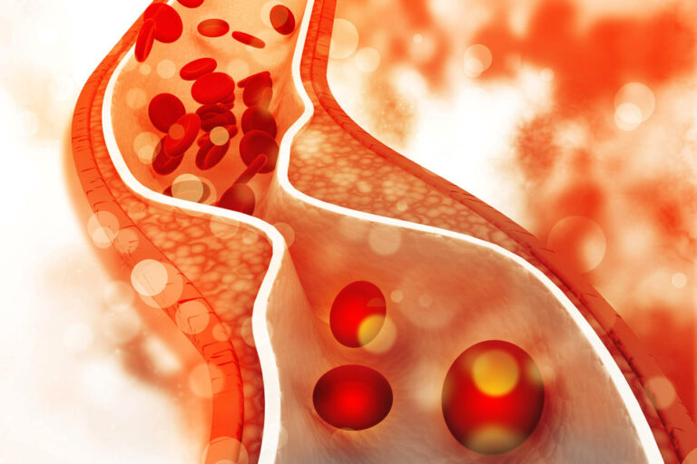 El 40% de los argentinos tiene colesterol alto