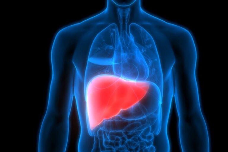 Hígado graso: los tres cambios que recomiendan los médicos para revertirlo sin pastillas